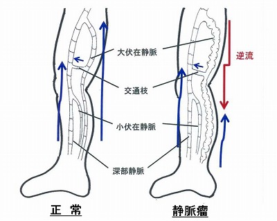 心臓血管外科 とりネット 鳥取県公式サイト