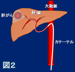 図２